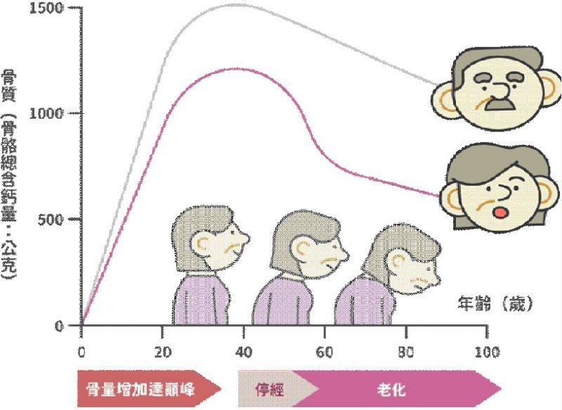 尖峰骨質 (Peak bone mass)與年齡曲線圖